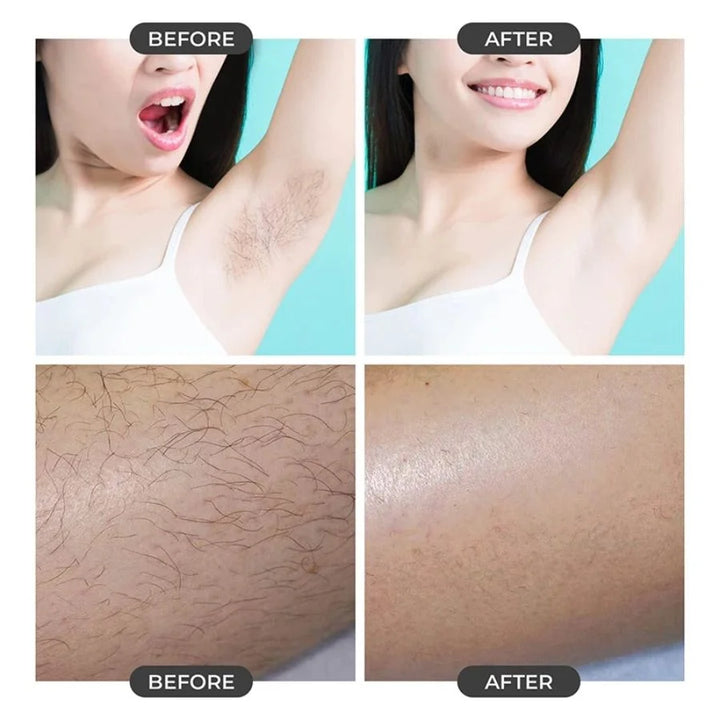 Before and after comparison showing smooth armpit and leg skin after using crystal hair eraser for painless hair removal